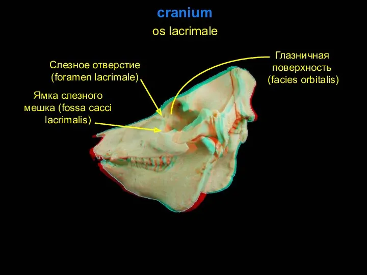 cranium Слезное отверстие (foramen lacrimale) Глазничная поверхность (facies orbitalis) Ямка