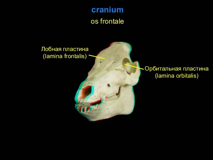 cranium os frontale Лобная пластина (lamina frontalis) Орбитальная пластина (lamina orbitalis)