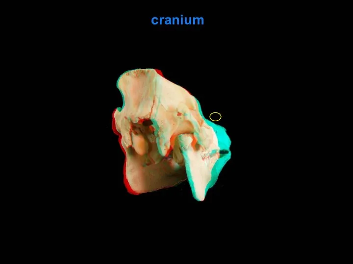 cranium