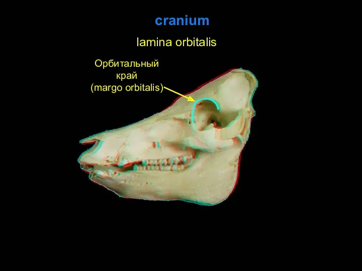 cranium Орбитальный край (margo orbitalis) lamina orbitalis