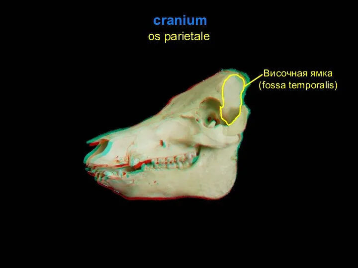 cranium os parietale Височная ямка (fossa temporalis)