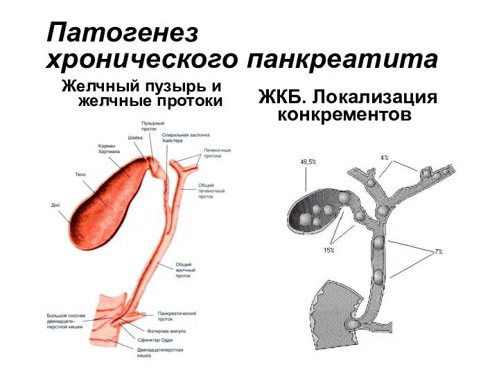 Патогенез хронического панкреатита Желчный пузырь и желчные протоки ЖКБ. Локализация конкрементов