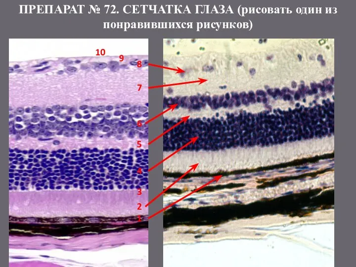 ПРЕПАРАТ № 72. СЕТЧАТКА ГЛАЗА (рисовать один из понравившихся рисунков) 1 2 3