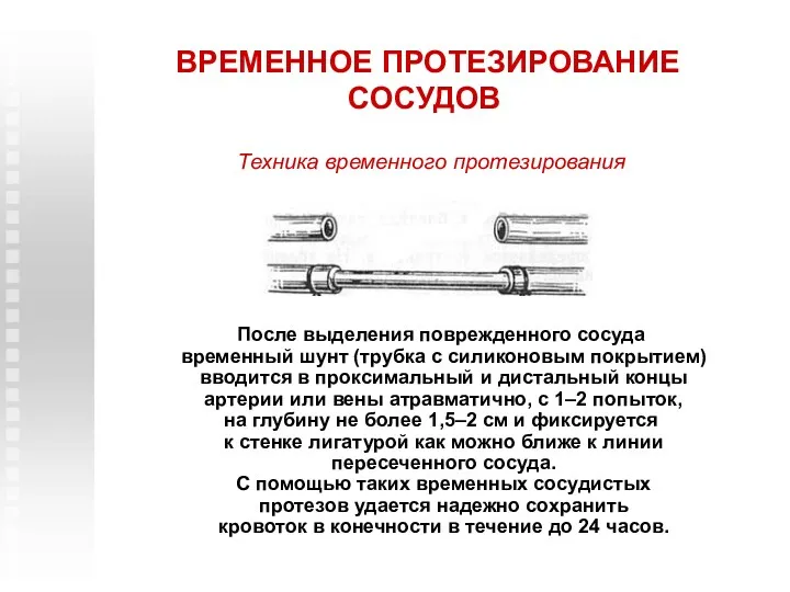 ВРЕМЕННОЕ ПРОТЕЗИРОВАНИЕ СОСУДОВ После выделения поврежденного сосуда временный шунт (трубка