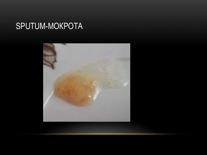 SPUTUM-МОКРОТА