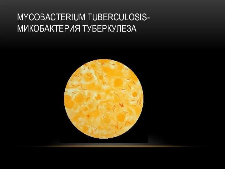 MYCOBACTERIUM TUBERCULOSIS-МИКОБАКТЕРИЯ ТУБЕРКУЛЕЗА