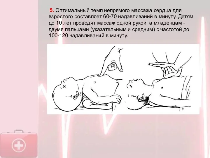 5. Оптимальный темп непрямого массажа сердца для взрослого составляет 60-70