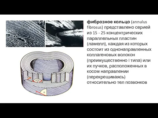 фиброзное кольцо (annulus fibrosus) представлено серией из 15 - 25 концентрических параллельных пластин