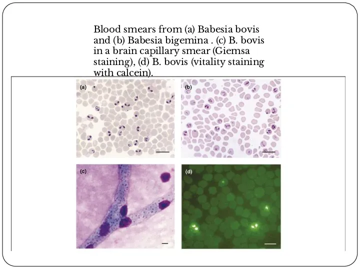 Blood smears from (a) Babesia bovis and (b) Babesia bigemina