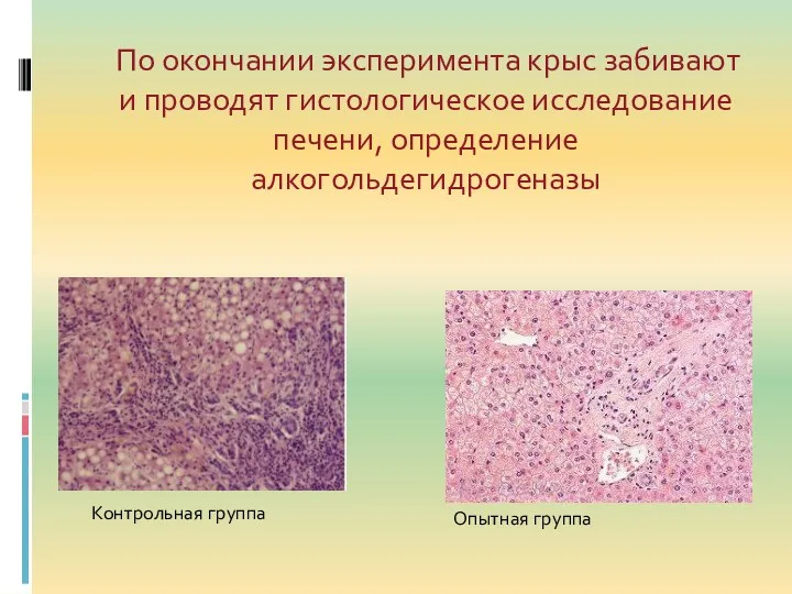 По окончании эксперимента крыс забивают и проводят гистологическое исследование печени, определение алкогольдегидрогеназы Контрольная группа Опытная группа