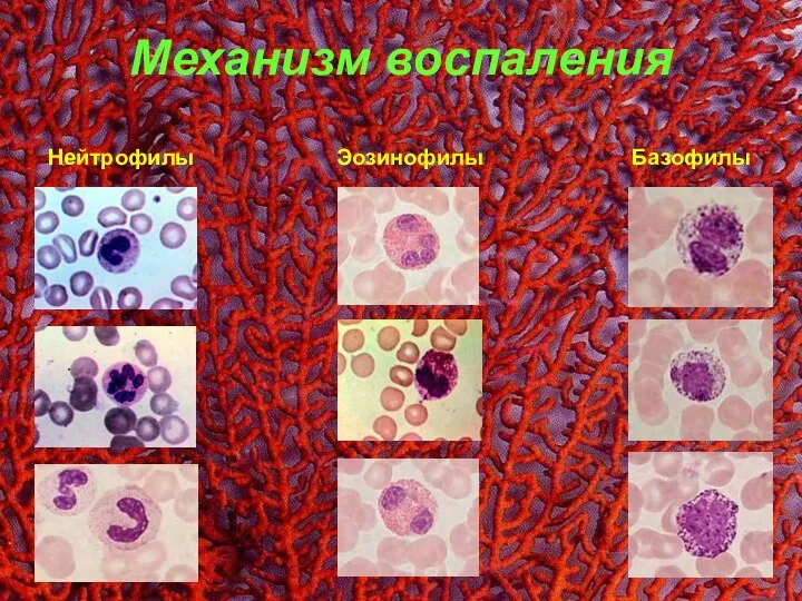 Механизм воспаления Нейтрофилы Эозинофилы Базофилы