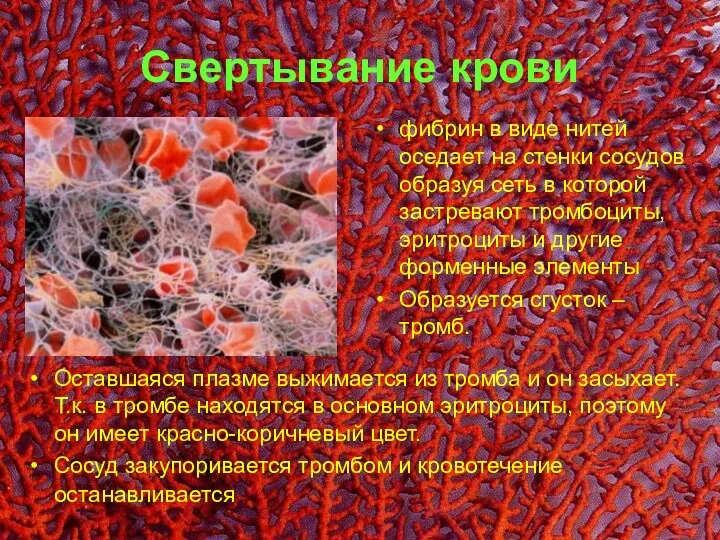 Свертывание крови фибрин в виде нитей оседает на стенки сосудов