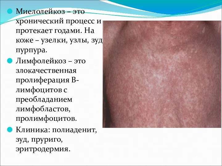 Миелолейкоз – это хронический процесс и протекает годами. На коже