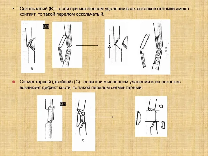 Оскольчатый (В) – если при мысленном удалении всех осколков отломки