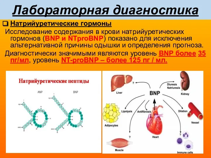 Лабораторная диагностика Натрийуретические гормоны Исследование содержания в крови натрийуретических гормонов (BNP и NTproBNP)