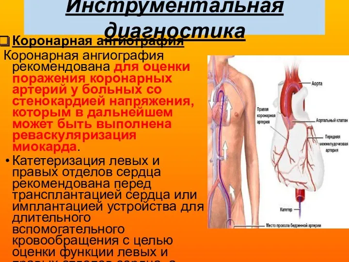 Инструментальная диагностика Коронарная ангиография Коронарная ангиография рекомендована для оценки поражения коронарных артерий у