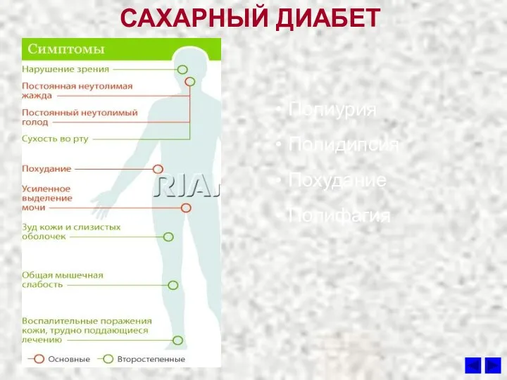 САХАРНЫЙ ДИАБЕТ Полиурия Полидипсия Похудание Полифагия