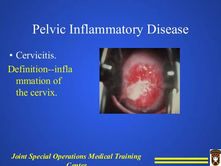 Pelvic Inflammatory Disease Cervicitis. Definition--inflammation of the cervix.