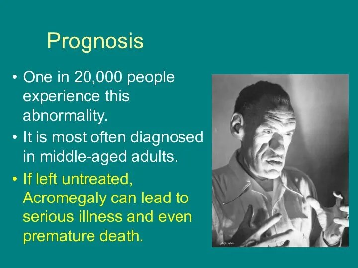 Prognosis One in 20,000 people experience this abnormality. It is