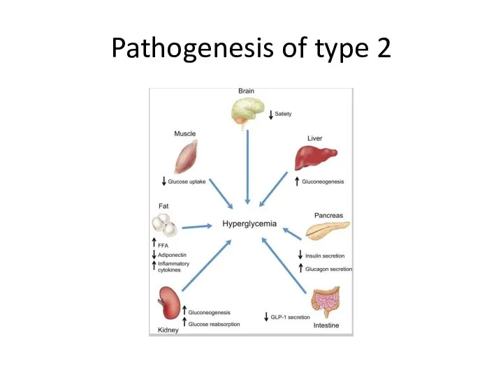 Pathogenesis of type 2
