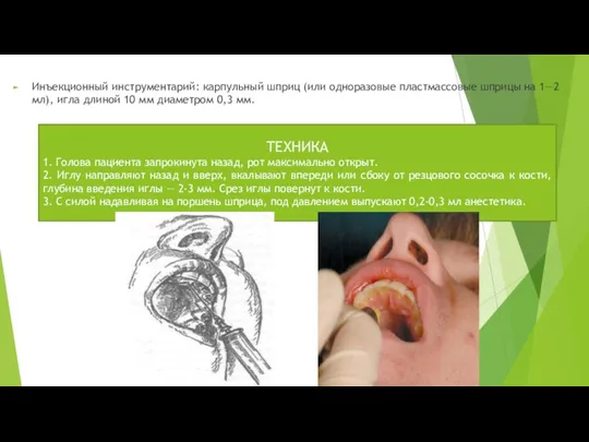 Инъекционный инструментарий: карпульный шприц (или одноразовые пластмассовые шприцы на 1—2