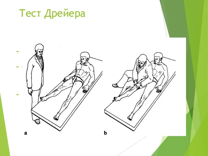 Тест Дрейера Предназначен для диагностики отрыва сухожилия четырёхглавой мышцы от верхнего полюса надколенника