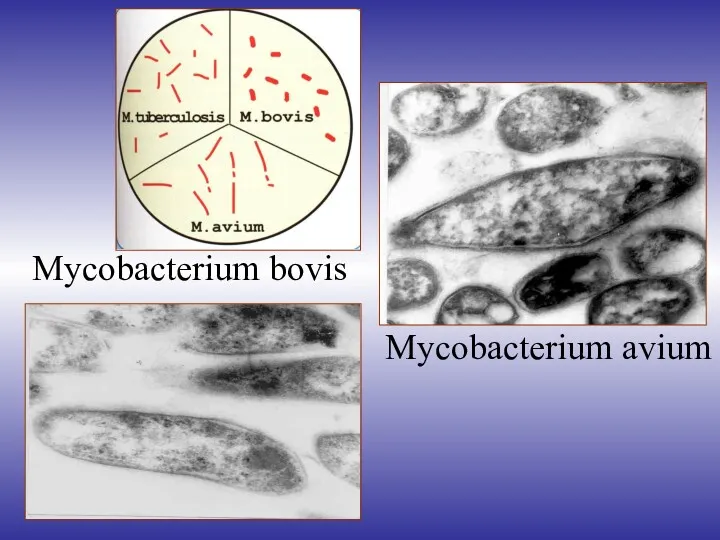 Mycobacterium bovis Mycobacterium avium
