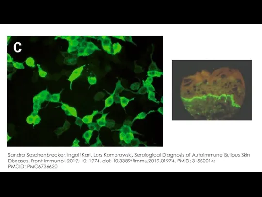 Sandra Saschenbrecker, Ingolf Karl, Lars Komorowski. Serological Diagnosis of Autoimmune Bullous Skin Diseases.