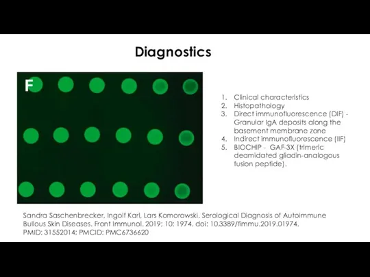 Diagnostics Clinical characteristics Histopathology Direct immunofluorescence (DIF) - Granular IgA deposits along the