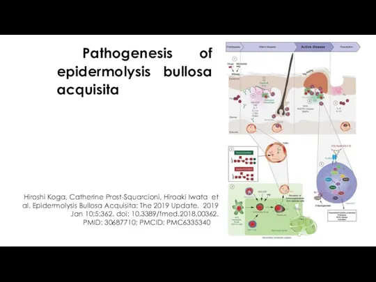 Pathogenesis of epidermolysis bullosa acquisita Hiroshi Koga, Catherine Prost-Squarcioni, Hiroaki Iwata et al.