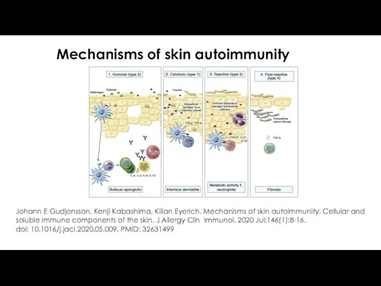 Mechanisms of skin autoimmunity Johann E Gudjonsson, Kenji Kabashima, Kilian