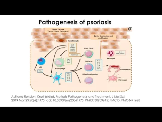 Pathogenesis of psoriasis Adriana Rendon, Knut Schäkel. Psoriasis Pathogenesis and