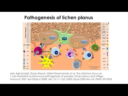 Pathogenesis of lichen planus Azin Aghamajidi, Ehsan Raoufi, Gilda Parsamanesh et al. The