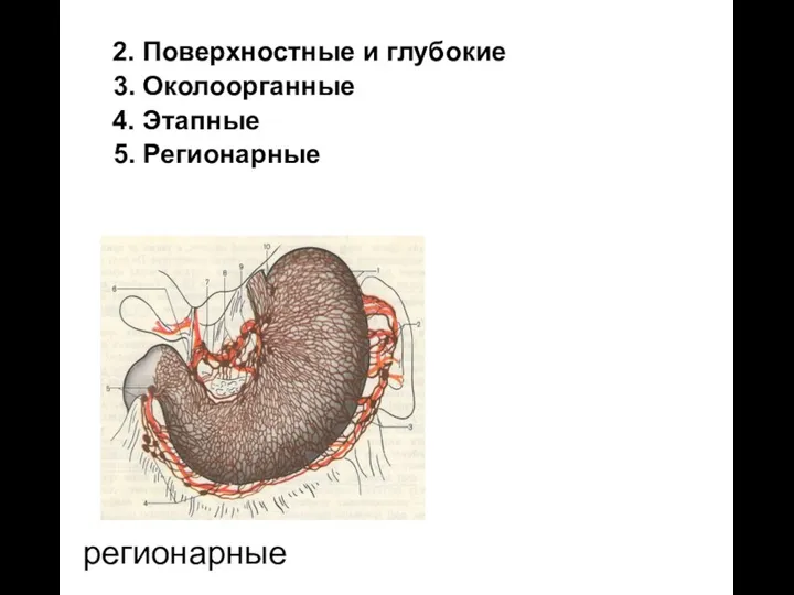 регионарные 2. Поверхностные и глубокие 3. Околоорганные 4. Этапные 5. Регионарные