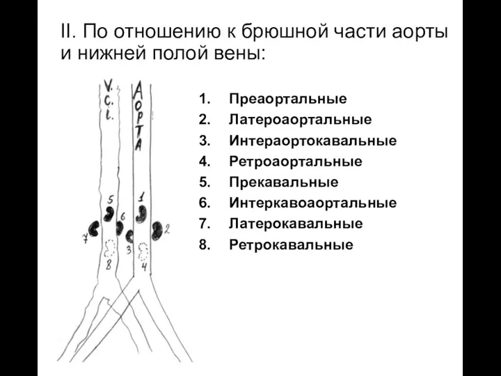 Преаортальные Латероаортальные Интераортокавальные Ретроаортальные Прекавальные Интеркавоаортальные Латерокавальные Ретрокавальные II. По