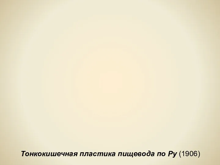 Тонкокишечная пластика пищевода по Ру (1906)