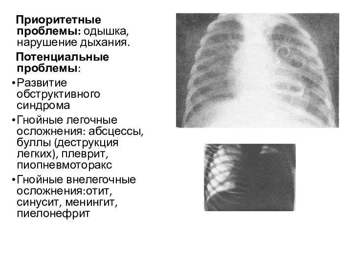 Приоритетные проблемы: одышка, нарушение дыхания. Потенциальные проблемы: Развитие обструктивного синдрома