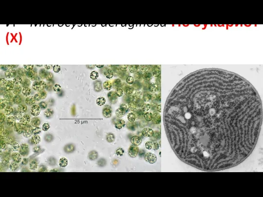 И – Microcystis aeruginosa Не эукариот (X)