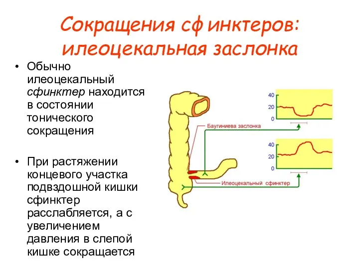 Сокращения сфинктеров: илеоцекальная заслонка Обычно илеоцекальный сфинктер находится в состоянии