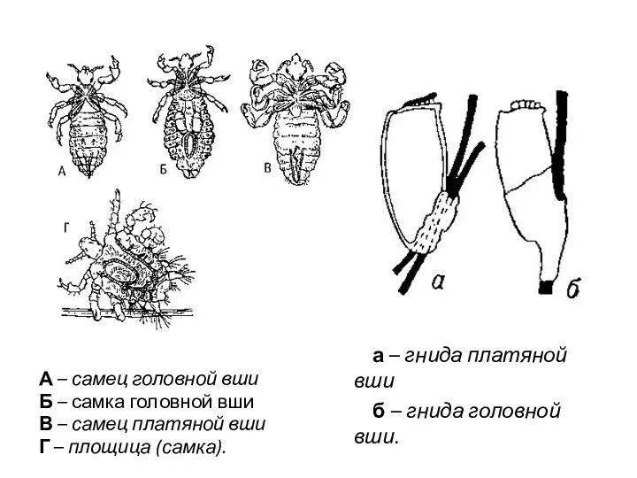 А – самец головной вши Б – самка головной вши