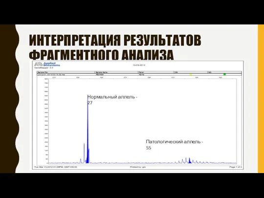 ИНТЕРПРЕТАЦИЯ РЕЗУЛЬТАТОВ ФРАГМЕНТНОГО АНАЛИЗА Нормальный аллель - 27 Патологический аллель - 55