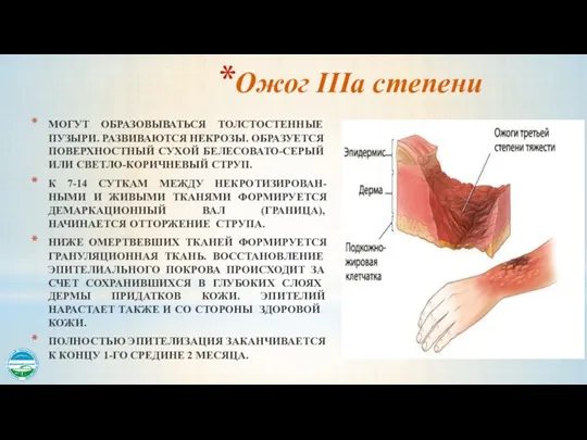 Ожог IIIа степени МОГУТ ОБРАЗОВЫВАТЬСЯ ТОЛСТОСТЕННЫЕ ПУЗЫРИ. РАЗВИВАЮТСЯ НЕКРОЗЫ. ОБРАЗУЕТСЯ