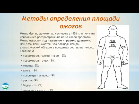 Методы определения площади ожогов Метод был предложен А. Уоллесом в