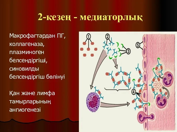 2-кезең - медиаторлық Макрофагтардан ПГ, коллагеназа, плазминоген белсендіргіші, синовилды белсендіргіш бөлінуі Қан және лимфа тамырларының ангиогенезі