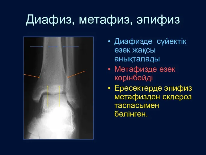 Диафиз, метафиз, эпифиз Диафизде сүйектік өзек жақсы анықталады Метафизде өзек көрінбейді Ересектерде эпифиз