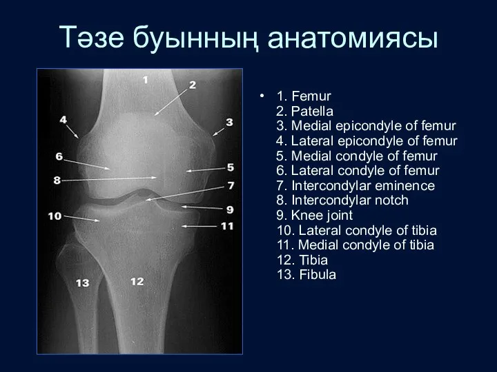 Тәзе буынның анатомиясы 1. Femur 2. Patella 3. Medial epicondyle of femur 4.