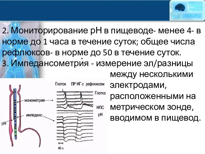 2. Мониторирование рН в пищеводе- менее 4- в норме до 1 часа в