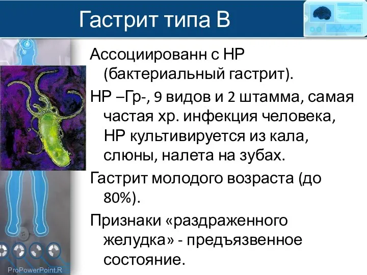 Гастрит типа В Ассоциированн с НР (бактериальный гастрит). НР –Гр-, 9 видов и