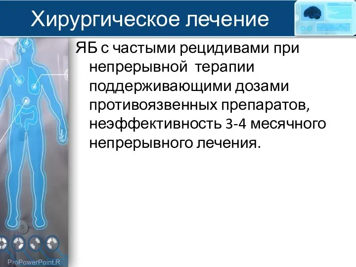 Хирургическое лечение ЯБ с частыми рецидивами при непрерывной терапии поддерживающими дозами противоязвенных препаратов,