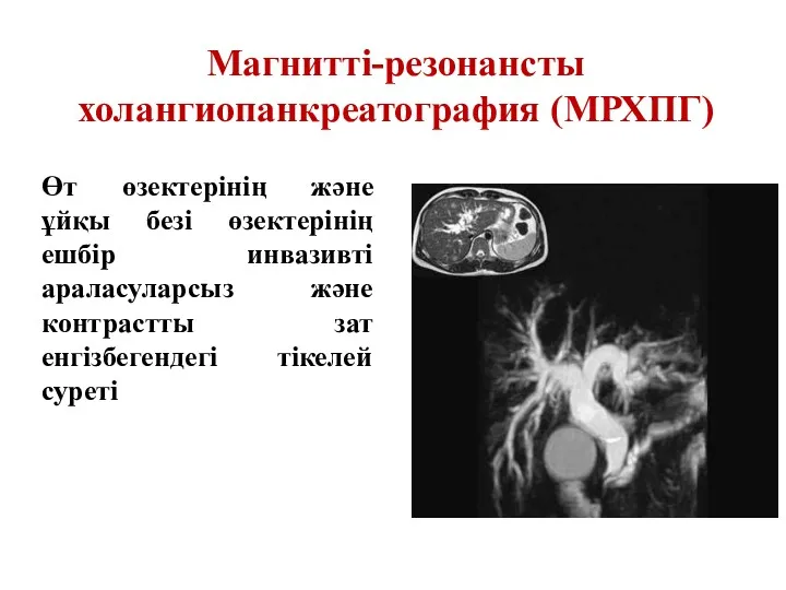 Магнитті-резонансты холангиопанкреатография (МРХПГ) Өт өзектерінің және ұйқы безі өзектерінің ешбір